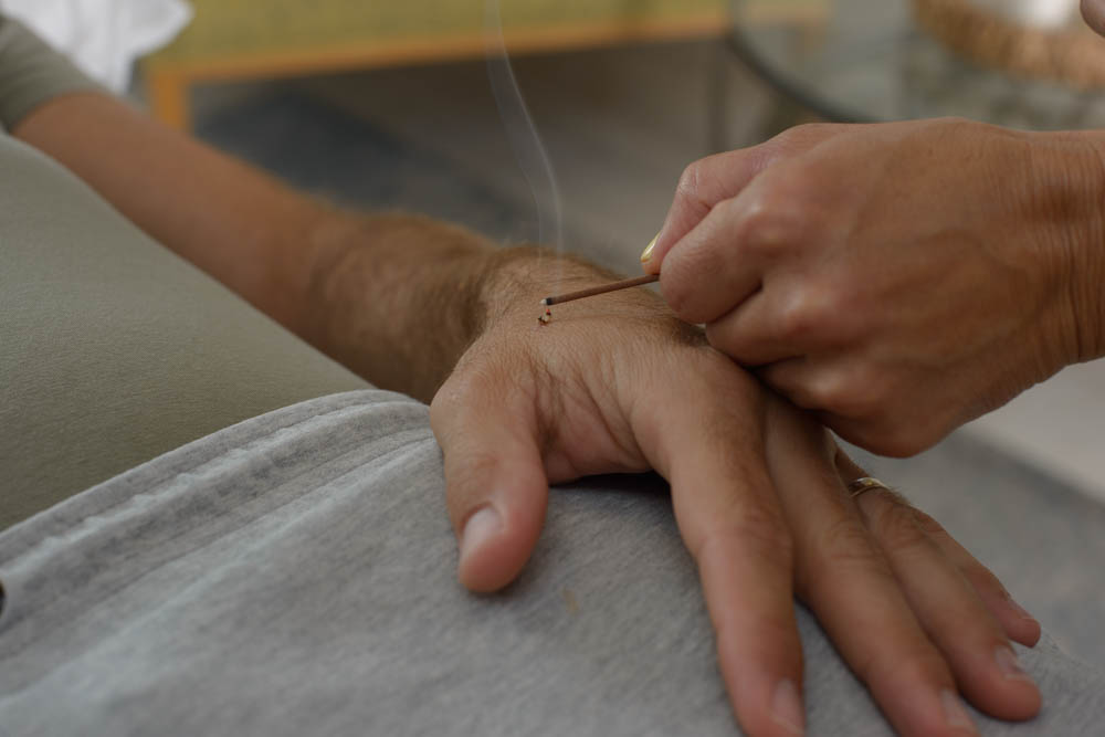 נעמה לודריק- דיקור יפני